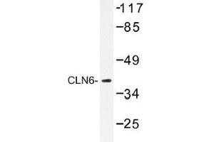 Image no. 1 for anti-Ceroid-Lipofuscinosis, Neuronal 6, Late Infantile, Variant (CLN6) antibody (ABIN317825) (CLN6 抗体)