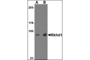 Western blot analysis of Rkhd1 in MDA-MB-361 cell lysate with this product at (A) 1 µg/ml and (B) 2 μg/ml. (MEX3D 抗体  (Center))