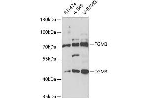 Western blot analysis of extracts of various cell lines, using TGM3 antibody (ABIN6132263, ABIN6149094, ABIN6149095 and ABIN6221560) at 1:1000 dilution. (TGM3 抗体  (AA 1-180))