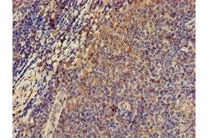 Immunohistochemistry (IHC) image for anti-Protein Kinase, CAMP-Dependent, Regulatory, Type II, alpha (PRKAR2A) (AA 43-205), (Regulatory Subunit) antibody (ABIN7146620)