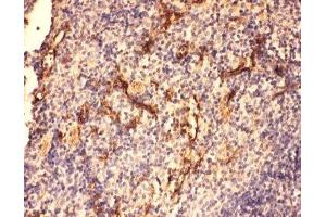 IHC-P: C5a antibody testing of mouse spleen tissue (C5A 抗体  (N-Term))