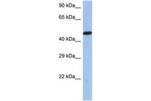Image no. 1 for anti-Interferon Regulatory Factor 5 (IRF5) (AA 395-444) antibody (ABIN6742243) (IRF5 抗体  (AA 395-444))