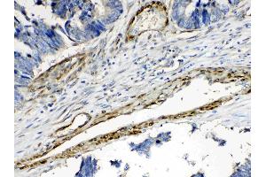 Immunohistochemistry (IHC) image for anti-Protein Phosphatase 1, Regulatory (Inhibitor) Subunit 14A (PPP1R14A) (AA 30-126) antibody (ABIN5518865)