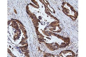 IHC analysis of RNF169 using anti-RNF169 antibody (ABIN6719530). (RNF169 抗体  (AA 311-708))