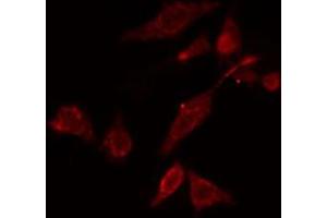 ABIN6274758 staining COLO cells by IF/ICC. (RPS5 抗体  (Internal Region))