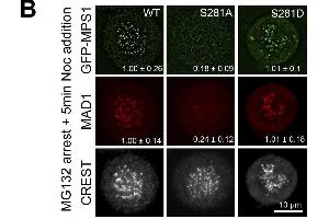 Immunofluorescence (Cultured Cells) (IF (cc)) image for anti-Proteasome (Prosome, Macropain) 26S Subunit, Non-ATPase, 14 (PSMD14) (Center) antibody (ABIN2856031)