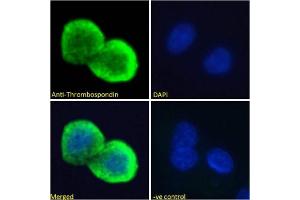 Immunoflorescence testing of permeabilized human HepG2 cells with Thrombospondin antibody at 10ug/ml. (Thrombospondin 1 抗体)