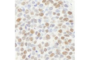 Immunohistochemistry (IHC) image for anti-Mismatch Repair Protein 2 (MSH2) (C-Term) antibody (ABIN7448673) (MSH2 抗体  (C-Term))