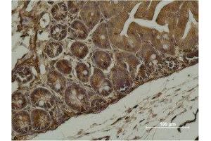 Immunohistochemistry (IHC) analysis of paraffin-embedded Mouse Cecal Tissue using alpha-SMA Monoclonal Antibody. (alpha-SMA 抗体)