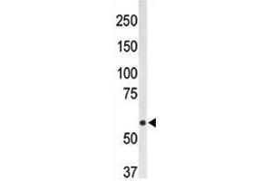 Image no. 1 for anti-5'-Nucleotidase, Ecto (CD73) (NT5E) (AA 1-30), (N-Term) antibody (ABIN357389) (CD73 抗体  (N-Term))