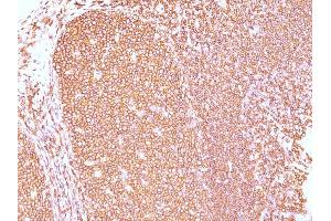 Formalin-fixed, paraffin-embedded human Tonsil stained with CD45RB Mouse Monoclonal Antibody (PD7/26). (CD45 抗体)