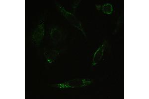 IHC analysis of PPP1R12A using anti-PPP1R12A antibody . (PPP1R12A 抗体  (N-Term))