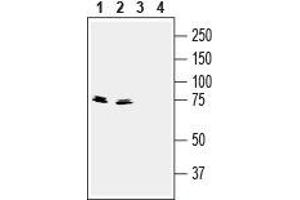 Western blot analysis of mouse (lanes 1 and 3) and rat (lanes 2 and 4) brain lysates: - 1,2. (Synapsin III 抗体  (C-Term, Extracellular))
