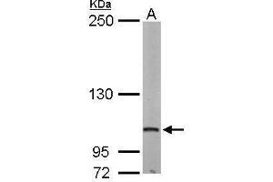 WB Image Sample (50 ug of whole cell lysate) A: Mouse brain 5% SDS PAGE antibody diluted at 1:500 (EIF4G2 抗体  (N-Term))