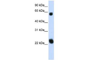WB Suggested Anti-KLHL26 Antibody Titration:  0. (KLHL26 抗体  (Middle Region))