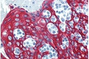 Tonsil, Human: Formalin-Fixed, Paraffin-Embedded (FFPE) (KRT14 抗体  (C-Term))
