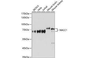 Western blot analysis of extracts of various cell lines, using N Antibody (ABIN6132231, ABIN6144337, ABIN6144339 and ABIN6215418) at 1:3000 dilution. (NAC1 抗体  (AA 170-340))