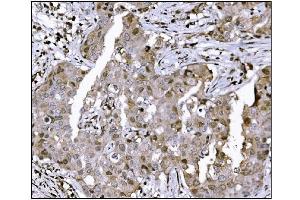 IHC analysis of KMT1B/SUV39H2 using anti-KMT1B/SUV39H2 antibody (ABIN7602135). (SUV39H2 抗体  (AA 6-410))