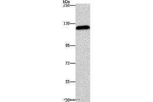 Western blot analysis of Hela cell, using AGAP2 Polyclonal Antibody at dilution of 1:700 (AGAP2 抗体)
