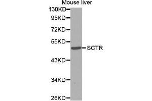Western Blotting (WB) image for anti-Secretin Receptor (SCTR) antibody (ABIN3017416) (SCTR 抗体)