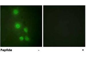 Immunofluorescence analysis of HUVEC cells, using ACTL6A polyclonal antibody . (BAF53A 抗体)