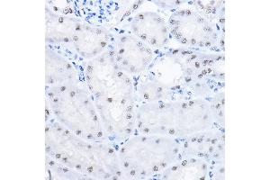 Immunohistochemistry of paraffin-embedded mouse kidney using SMEK1 Rabbit pAb (ABIN6130699, ABIN6148130, ABIN6148131 and ABIN6224584) at dilution of 1:100 (40x lens). (SMEK1 抗体  (AA 395-594))
