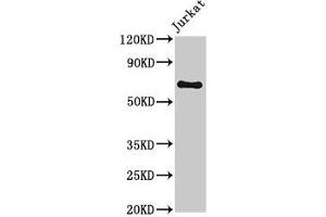 Western Blot Positive WB detected in: Jurkat whole cell lysate All lanes: GNL1 antibody at 3. (GNL1 抗体  (AA 251-500))