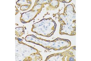 Immunohistochemistry of paraffin-embedded human placenta using Placental alkaline phosphatase (PLAP) antibody (ABIN6127420, ABIN6136826, ABIN6136827 and ABIN6221966) at dilution of 1:100 (40x lens). (PLAP 抗体  (AA 260-460))