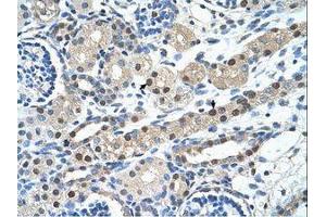 Image no. 1 for anti-Inhibin Binding Protein (INHBP) (AA 151-200) antibody (ABIN203489) (IGSF1 抗体  (AA 151-200))