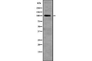 Western blot analysis of RALGDS expression in Liver (Human) Tissue Lysate ,The lane on the left is treated with the antigen-specific peptide. (RALGDS 抗体  (N-Term))