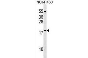 Western Blotting (WB) image for anti-Mitochondrial Ribosomal Protein L54 (MRPL54) antibody (ABIN2999653) (MRPL54 抗体)