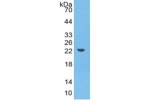 Western Blotting (WB) image for Haptoglobin (HP) ELISA Kit (ABIN6574214)
