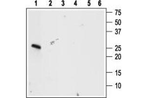 Western blot analysis using Anti-proBDNF Antibody (ABIN7043558, ABIN7044753 and ABIN7044754), (1:400): - 1. (Pro BDNF 抗体  (Pro-Domain))