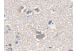 Detection of ME2 in Human Cerebrum Tissue using Polyclonal Antibody to Malic Enzyme 2, NADP+ Dependent, Mitochondrial (ME2)