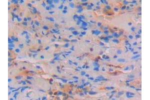 Detection of STAT4 in Human Lung Tissue using Polyclonal Antibody to Signal Transducer And Activator Of Transcription 4 (STAT4) (STAT4 抗体  (AA 505-737))