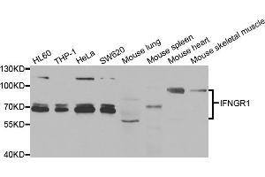 Western blot analysis of extracts of various cell lines, using IFNGR1 antibody (ABIN5973372) at 1/1000 dilution. (IFNGR1 抗体)