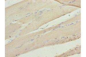 Immunohistochemistry of paraffin-embedded human skeletal muscle tissue using ABIN7146719 at dilution of 1:100 (CA3 抗体  (AA 2-260))