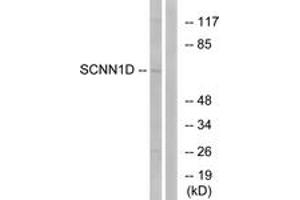 Western Blotting (WB) image for anti-Sodium Channel, Nonvoltage-Gated 1, delta (SCNN1D) (AA 411-460) antibody (ABIN2890112) (SCNN1D 抗体  (AA 411-460))