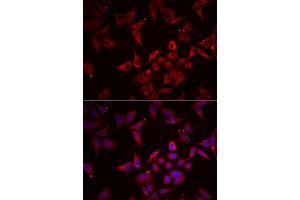 Immunofluorescence analysis of U2OS cells using NCR3 antibody (ABIN5974302). (NCR3 抗体)