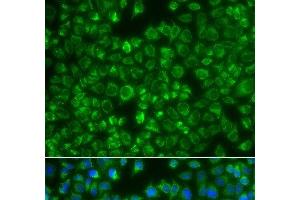 Immunofluorescence analysis of A549 cells using MTMR4 Polyclonal Antibody (MTMR4 抗体)