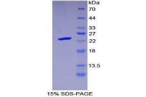 SDS-PAGE (SDS) image for Protease, serine, 1 (Trypsin 1) (PRSS1) (AA 51-228) protein (His tag) (ABIN2126461) (PRSS1 Protein (AA 51-228) (His tag))
