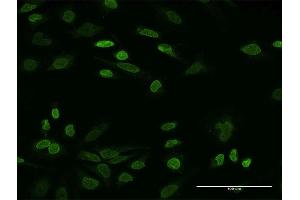 Immunofluorescence of monoclonal antibody to NHS on HeLa cell. (Nhs 抗体  (AA 1532-1629))