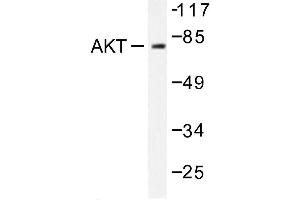 Image no. 1 for anti-V-Akt Murine Thymoma Viral Oncogene Homolog 1 (AKT1) antibody (ABIN271988) (AKT1 抗体)