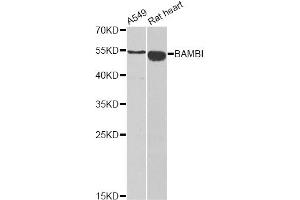 Western blot analysis of extracts of various cell lines, using BAMBI antibody (ABIN2561326) at 1:1000 dilution.
