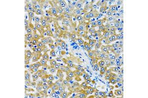 Immunohistochemistry of paraffin-embedded rat liver using HD antibody (ABIN6133742, ABIN6141675, ABIN6141678 and ABIN6213911) at dilution of 1:100 (40x lens). (HDAC5 抗体  (AA 550-650))