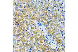 Immunohistochemistry of paraffin-embedded rat liver using HD antibody (ABIN6133742, ABIN6141675, ABIN6141678 and ABIN6213911) at dilution of 1:100 (40x lens).
