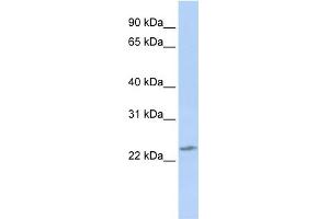 WB Suggested Anti-RBPMS2 Antibody Titration:  0. (RBPMS2 抗体  (Middle Region))