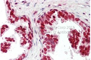 Rabbit Anti-CIRBP antibody Catalog Number: ARP40348 Formalin Fixed Paraffin Embedded Tissue: Human Adult Prostate  Observed Staining: Cytoplasm in hepatocytes Primary Antibody Concentration: 1:600 Secondary Antibody: Donkey anti-Rabbit-Cy3 Secondary Antibody Concentration: 1:200 Magnification: 20X Exposure Time: 0. (CIRBP 抗体  (Middle Region))