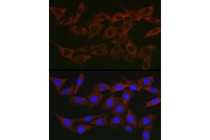 Immunofluorescence analysis of NIH/3T3 cells using WNK3 Rabbit pAb (ABIN7271382) at dilution of 1:200 (40x lens). (WNK3 抗体  (AA 500-600))