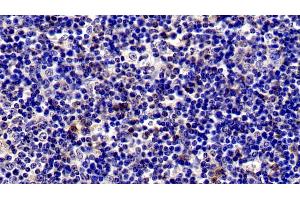 Detection of IL2Ra in Porcine Lymph node Tissue using Polyclonal Antibody to Interleukin 2 Receptor Alpha (IL2Ra)